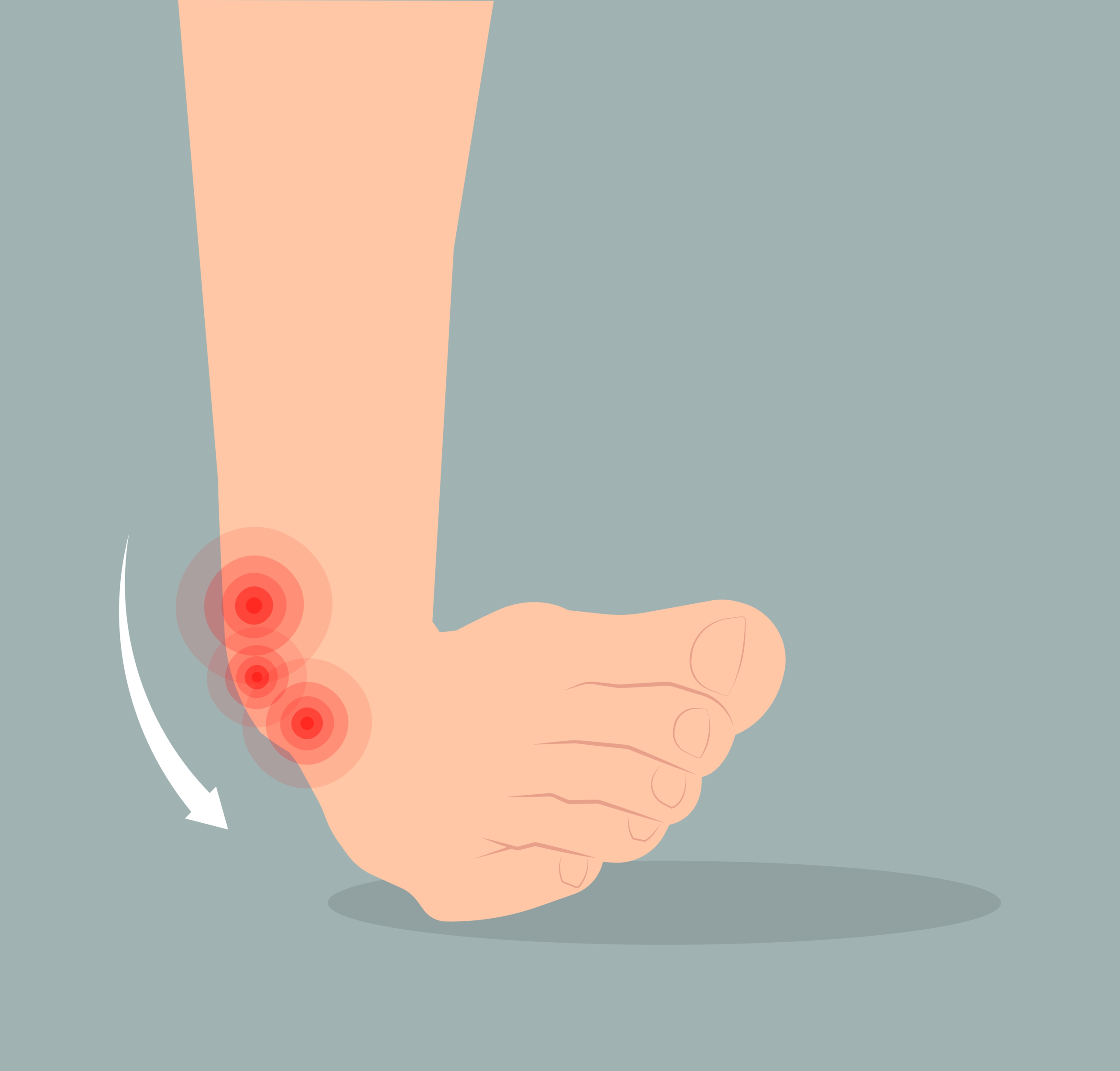 التواء الكاحل| shutterstock