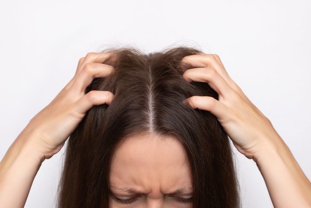 الحكة بسبب قشرة الرأس| shutterstock