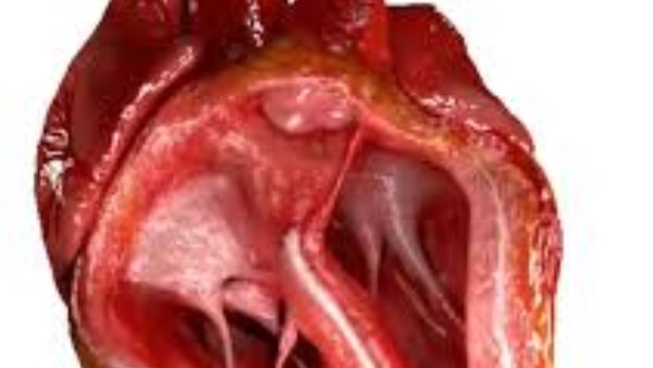 اكتشاف ثوري.. القلب يحتوى على دماغ صغير يؤثر على صحتنا النفسية والجسدية