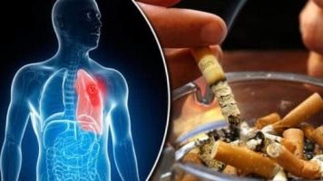 طرق الوقاية من سرطان الرئة
