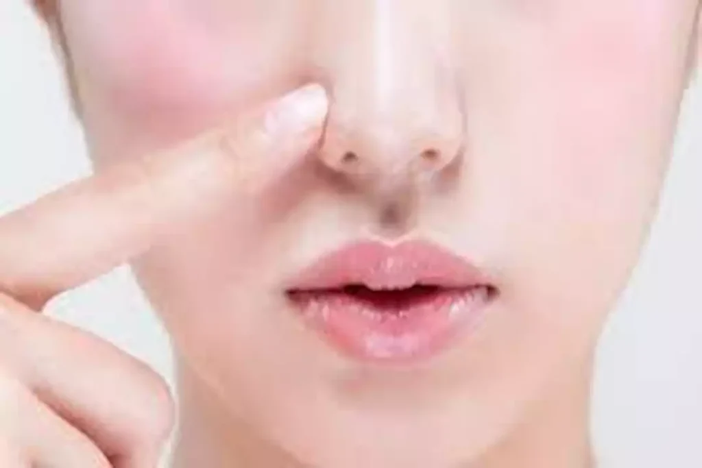 كيف تميز التهاب الأنف؟ 5 علامات تحذيرية مهمة