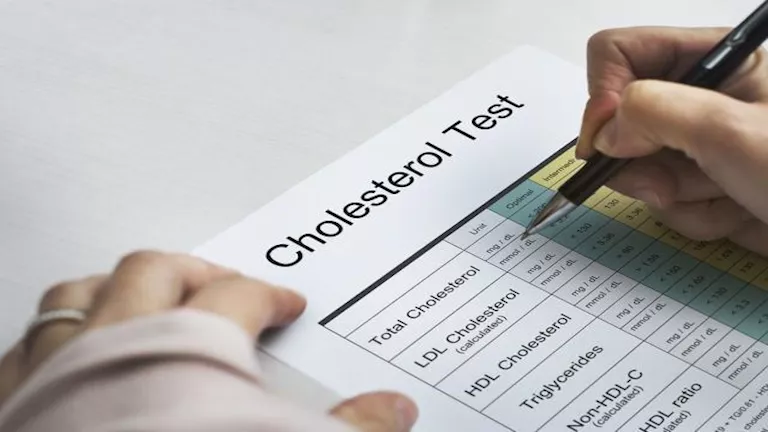 احذر تجاهلها.. 4 حقائق عن الكوليسترول وعلاقته بالقلب