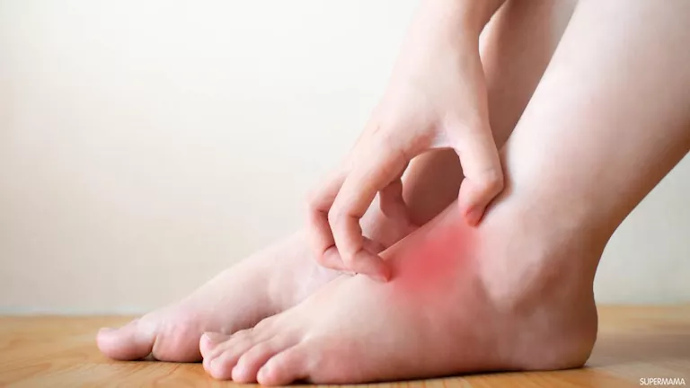 بينها أمراض الكبد.. حكة القدم قد تكشف مشاكل صحية خطيرة
