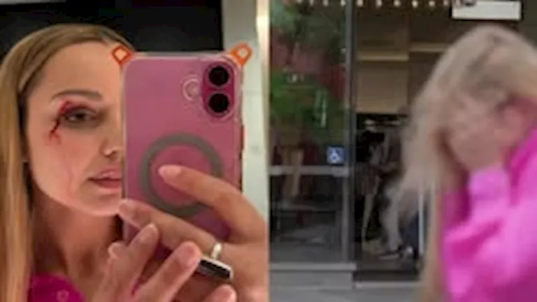 مراسلة تلفزيونية تنزف على الهواء مباشرة بسبب موقف غريب.. ما القصة؟