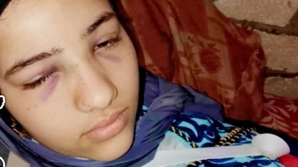 وضعت في ثلاجة الموتي بالخطأ.. ماساة فتاة أصيبت في حادث الطريق الصحراوي