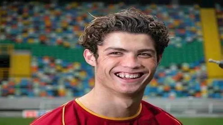 “بينهم لاعب الأهلي السابق”.. 20 صورة لنجوم كرة قدم أجروا عمليات تجميل