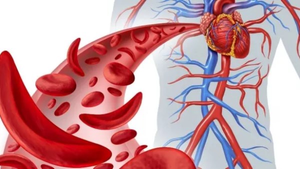 مش تعب وخلاص.. فقر الدم خطر صحي يهدد النساء والأطفال