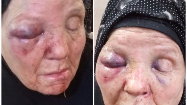 عاق ومدمن.. حبس الابن المعتدي بالضرب علي أمه بزفتي 4 أيام