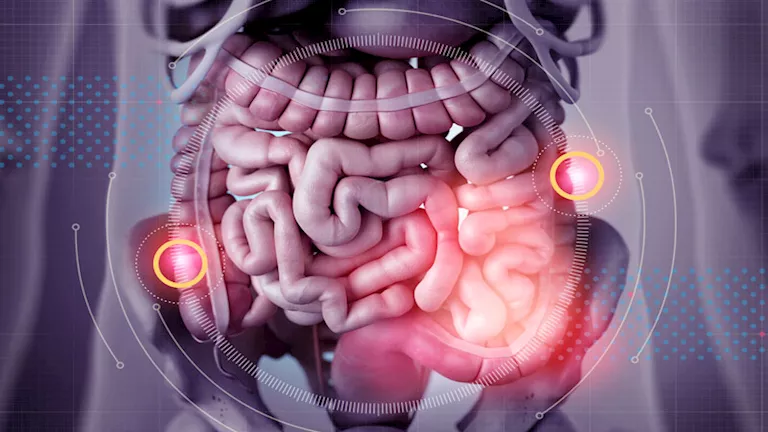 7 علامات واضحة تكشف إصابتك بجرثومة المعدة