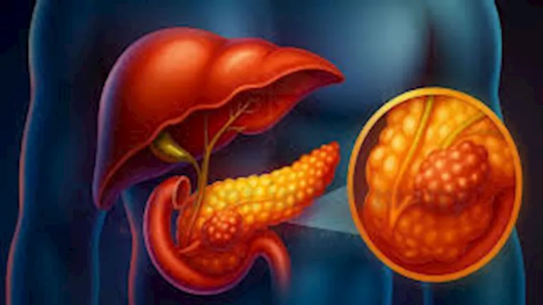 7 علامات على الوجه تكشف الإصابة بسرطان البنكرياس