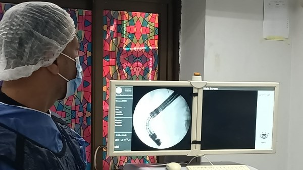 فريق طبي بحميات قنا ينقذ مريضا من انسداد حاد بالقنوات المرارية