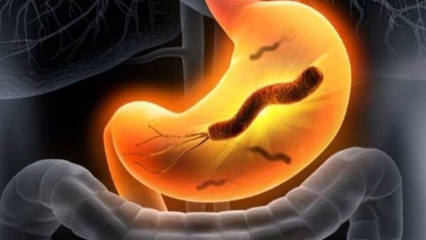 إهمالها يؤدى للسرطان .. اكتشف أسباب جرثومة المعدة
