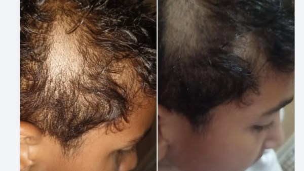 تعليم القاهرة تحقق في الواقعة المتداولة بشأن قيام معلم بحلق شعر تلميذ في الطابور