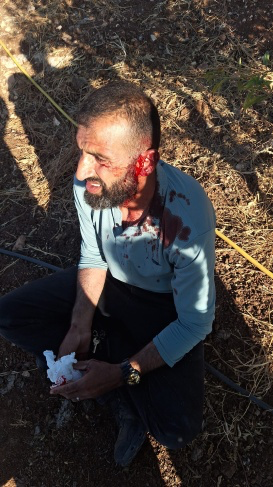 مستوطنون يعتدون على مزارعين في بيت فوريك شرق نابلس