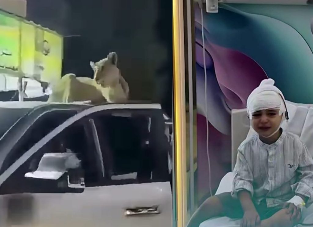 لبوة تهاجم طفلاً في أعزاز.. إصابات خطيرة وتدخل سلطات محلي